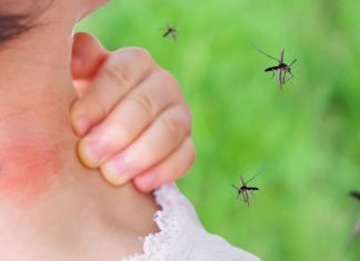 cute asian baby girl has rash and allergy on neck skin from mosquito bite and sucking blood while playing outdoor