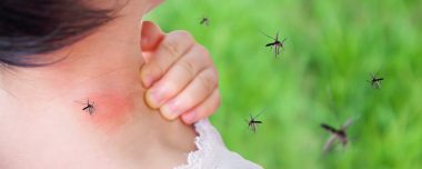 cute asian baby girl has rash and allergy on neck skin from mosquito bite and sucking blood while playing outdoor