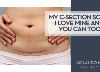 My C-Section Scar: I love mine and you can too