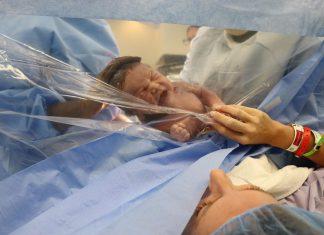 baby pushed against clear plastic after a c-section to show mama who reaches hand to clear plastic.