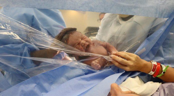 baby pushed against clear plastic after a c-section to show mama who reaches hand to clear plastic.