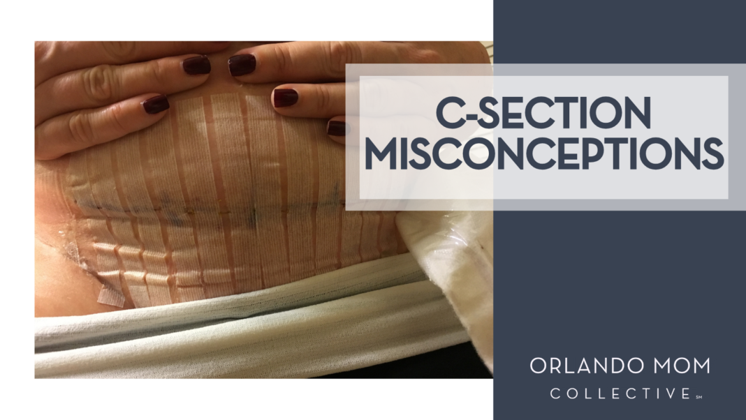 C-Section Misconceptions