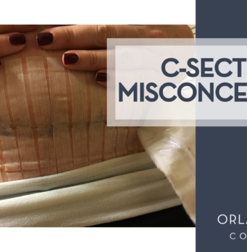 Let’s Clear Up Some C-Section Misconceptions, Shall We?