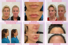 Soluma Aesthetics Med Spa - Orlando